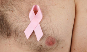Cáncer de mama en hombres