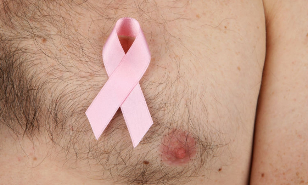 Cáncer de mama en hombres