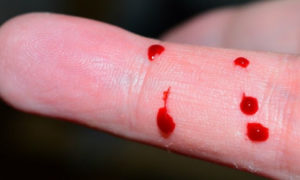 Hombre llora lágrimas de sangre