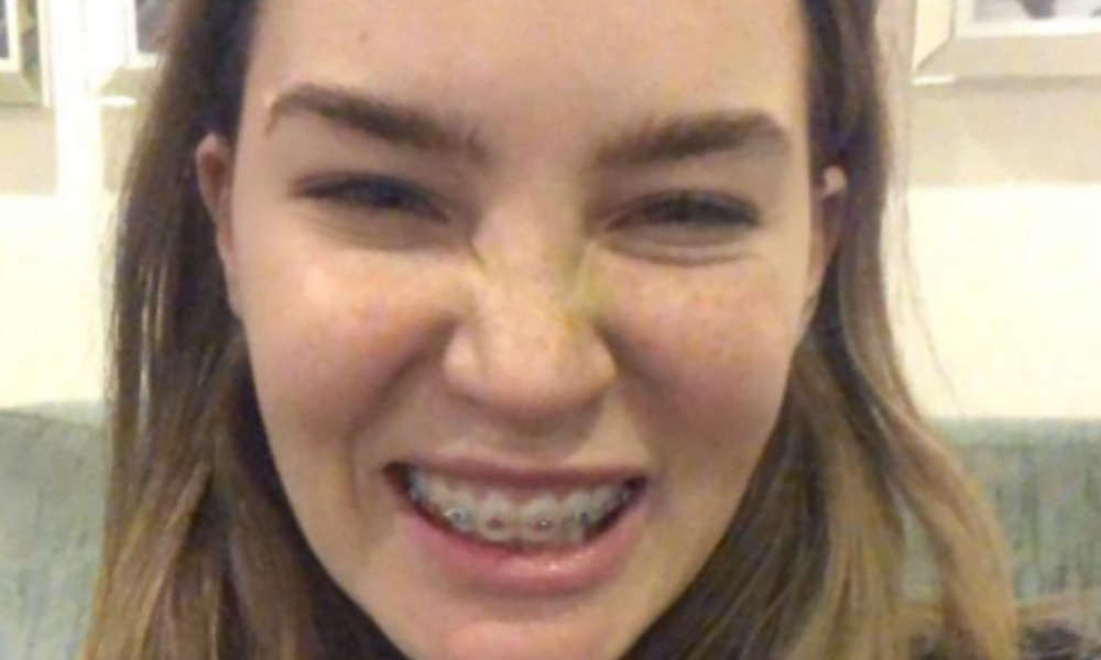 Belinda reveló por qué se puso brackets